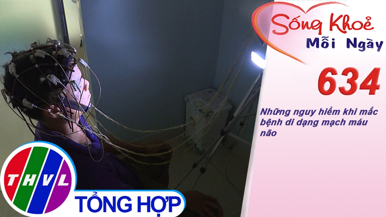 Những nguy hiểm khi mắc bệnh dị dạng mạch máu não | Sống khỏe mỗi ngày - Kỳ 634