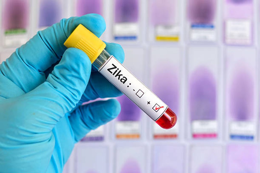 El virus del Zika podría ser la respuesta con el cáncer de cerebro