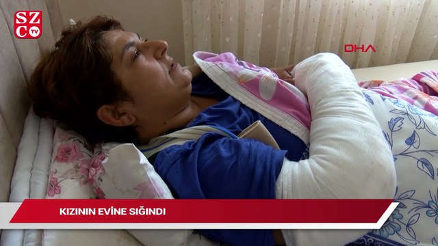 Kayınbiraderinin baltalı saldırısında yaralanan kadın, evine gidemiyor