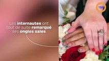 Les ongles sales du marié lui valent d’être traité de « dégoûtant » sur les réseaux sociaux !