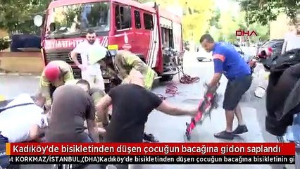 Kadıköy'de bisikletinden düşen çocuğun bacağına gidon saplandı