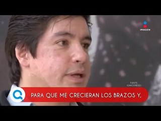 Nadador sin brazos reacciona a halagos de sus brazadas | Qué Importa