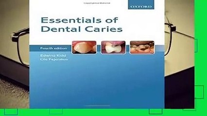 [Doc] Essentials of Dental Caries