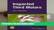 [FREE] Impacted Third Molars