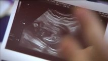 La listeriosis provoca tres nuevos abortos en las últimas horas