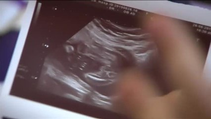La listeriosis provoca tres nuevos abortos en las últimas horas