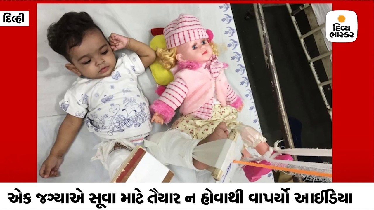 11 મહિનાની બાળકીના પગના ફ્રેક્ચરની સારવાર કરવા ડોક્ટરે તેની ઢીંગલીને પણ પ્લાસ્ટરનો પાટો બાંધ્યો