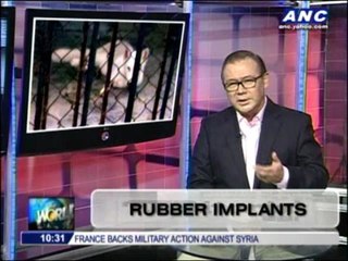 Teditorial: Rubber implants