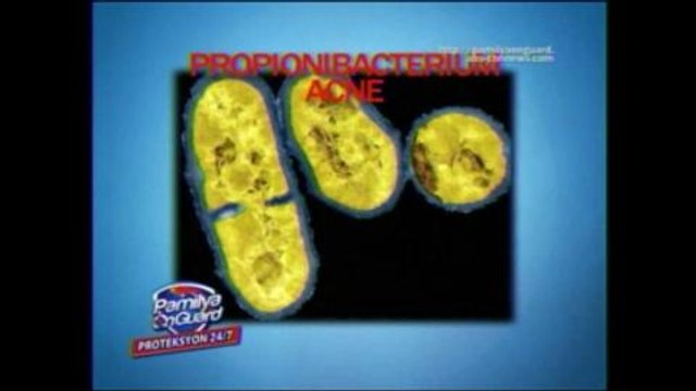 pamilyaonguard-75% OF TEENAGERS SUFFER FROM ACNE