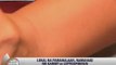 Leptospirosis outbreak declared in Olongapo
