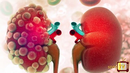 কিডনিতে রোগ সৃষ্টি করে অ্যান্টাসিড মাদকদ্রব্য