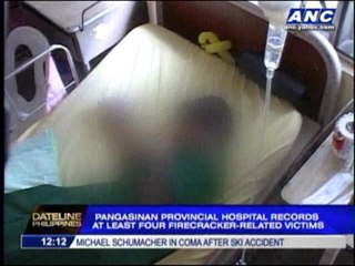 Pangasinan boy loses three fingers due to firecracker