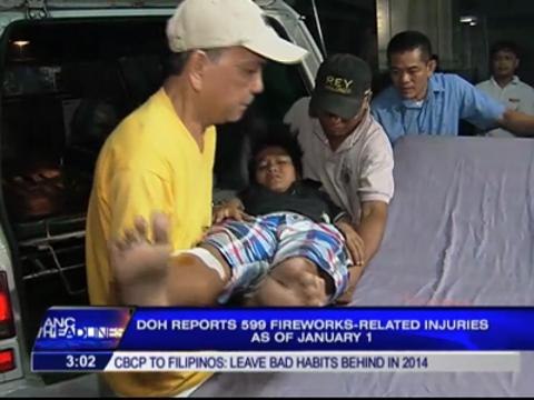599 fireworks-related injuries reported