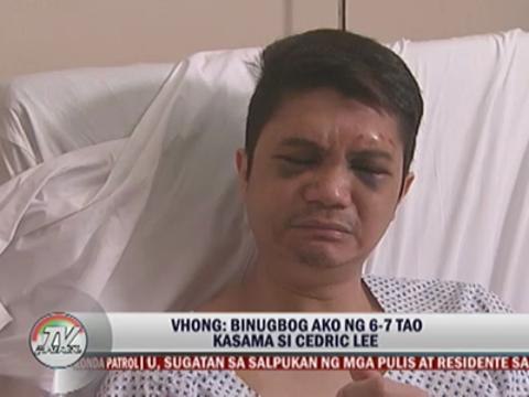 Vhong to undergo reconstructive nose surgery