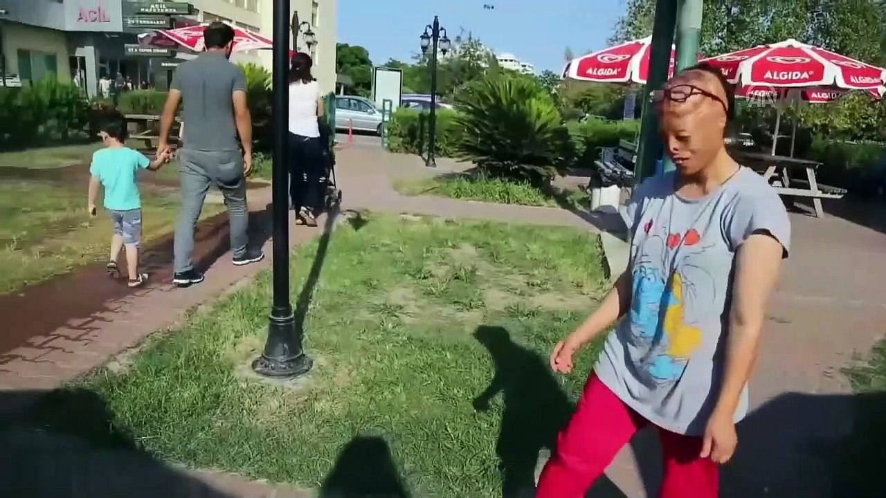 Yüz nakli için ekip her zaman hazır - ANTALYA