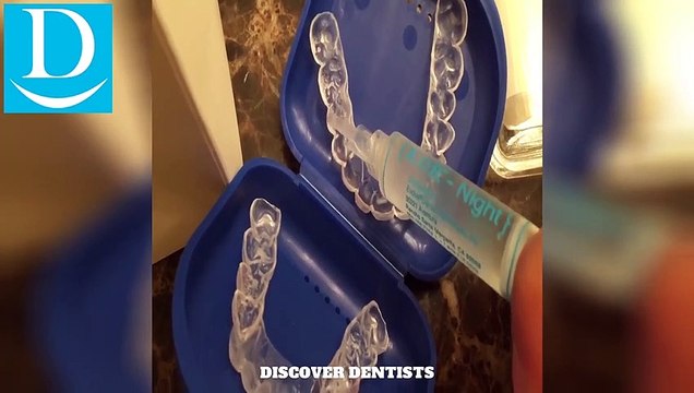 DISCOVER DENTISTS® Teeth Whitening