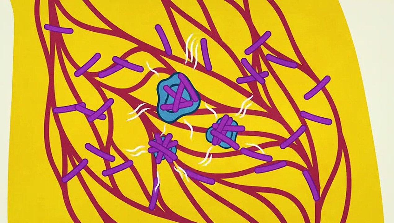 What makes TB the world's most infectious killer -