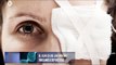 Lesiones comunes en los ojos, ¿cómo evitarlas o tratarlas?
