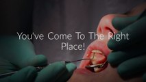 Gentle Touch Dentistry : Tooth Extraction in Fullerton