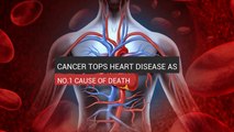 Cancer Tops Heart Disease As No.1 Cause Of Death