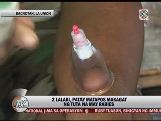 Rabies kills 2 in La Union