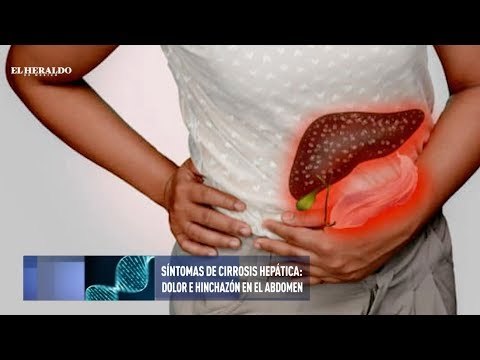 Afecciones del hígado debido a la cirrosis