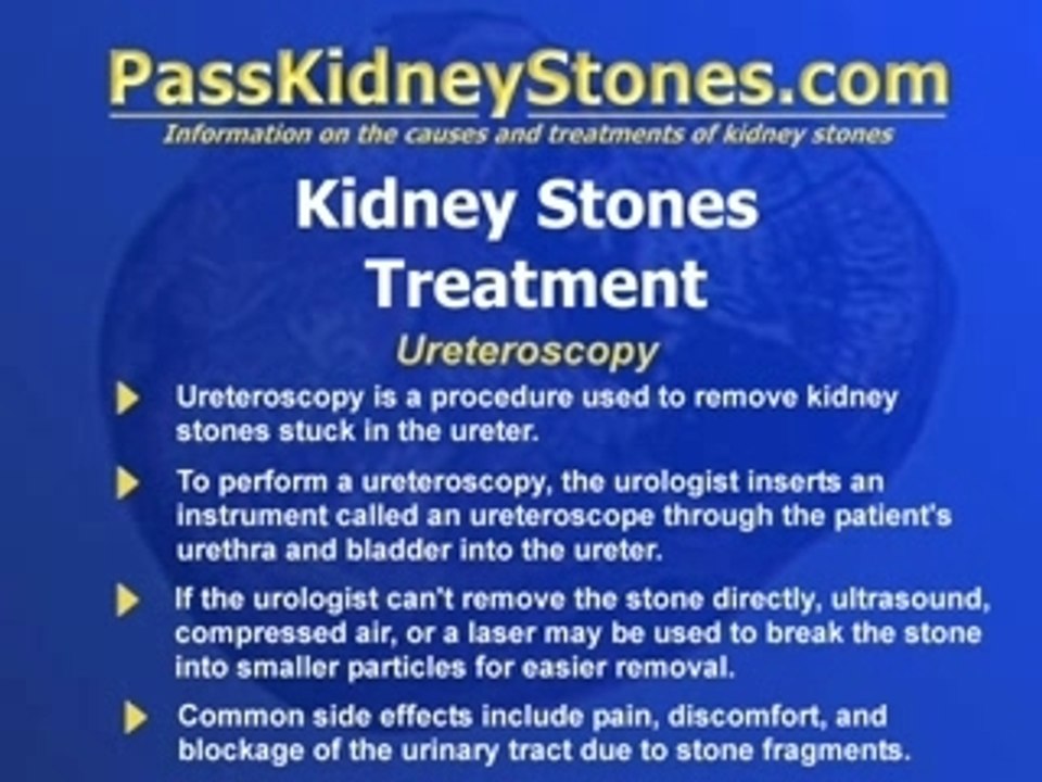 Ureteroscopy