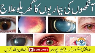 Eye Infection Home Remedies treatment || How To Improve Eyesight || آنکھوں کی انفیکشن کا علاج