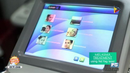 DERMAESTHETIC: Melasma treatment using Nd:YAG laser