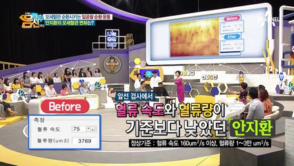 '일공팔 순환 운동' 후 안지환&송옥숙의 모세혈관에 찾아온 놀라운 변화!