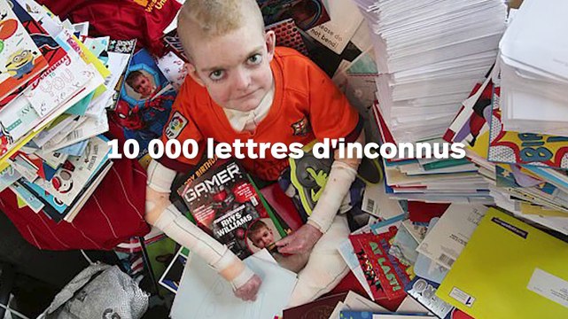 Un « enfant papillon » agonisant reçoit 10 000 cartes d’anniversaire d’inconnus !