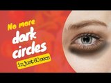 How to get rid off dark circles at home | homeremedy