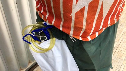 Pedreiro de Itambé precisa de R$ 8.000 para fazer cirurgia