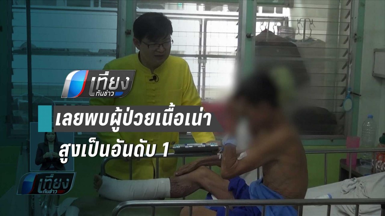 สสจ.เลยพบผู้ป่วยเนื้อเน่าสูงเป็นอันดับ 1 ติดต่อ...