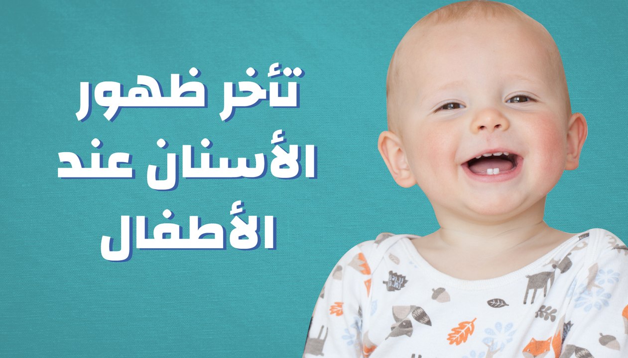 تأخر ظهور الأسنان عند الأطفال