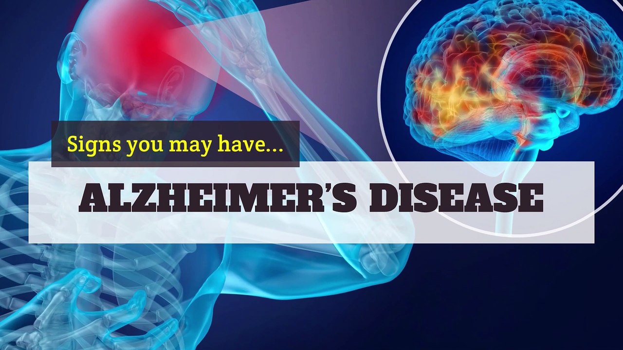 Alzheimer's - Signs you may have Alzheimer’s disease