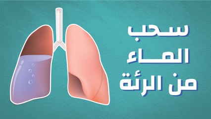 سحب الماء من الرئة