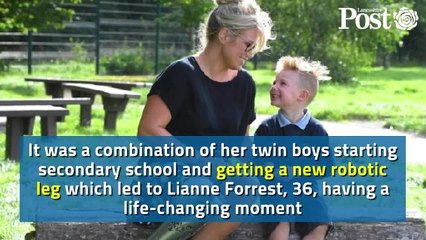 Lancashire mum-of-two embraced being an amputee