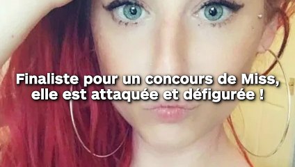 Finaliste pour un concours de Miss, elle est attaquée sauvagement !