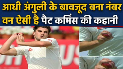 Pat Cummins became number one Test bolwer despite lost part of his finger | वनइंडिया हिंदी
