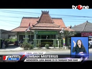 Kulit Ahmad Dani Melepuh Terkena Limbah Misterius