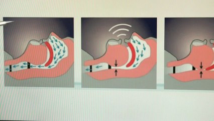 Santé - Je dors pour mes yeux