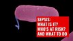Everything You Need to Know About sepsis