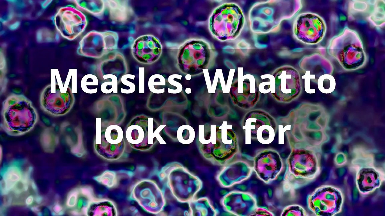 Measles - What to look out for