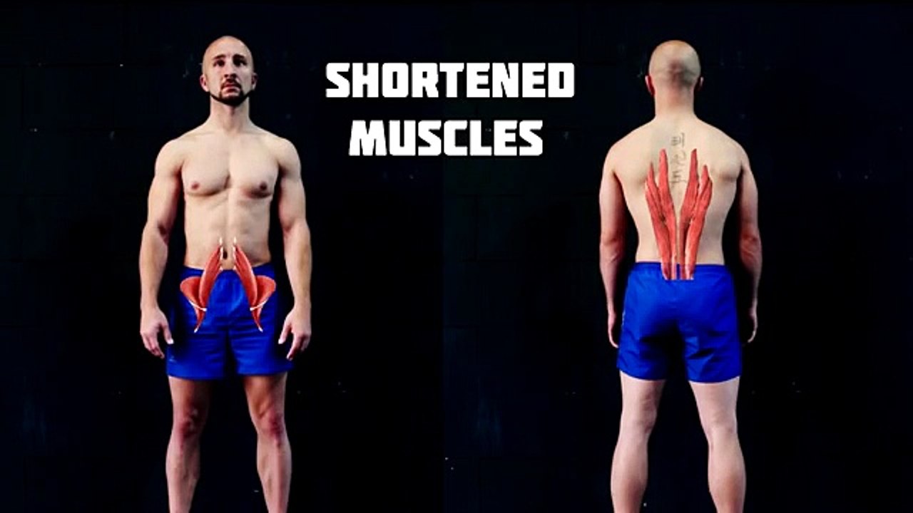 Fix Lower Back Pain 3 Easy Tips