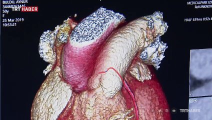 Öğle uykusu kalbe iyi geliyor