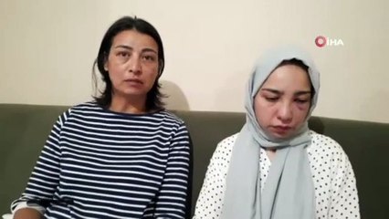 17 yaşındaki kızı köpek yüzünden acımasızca darp ettiler