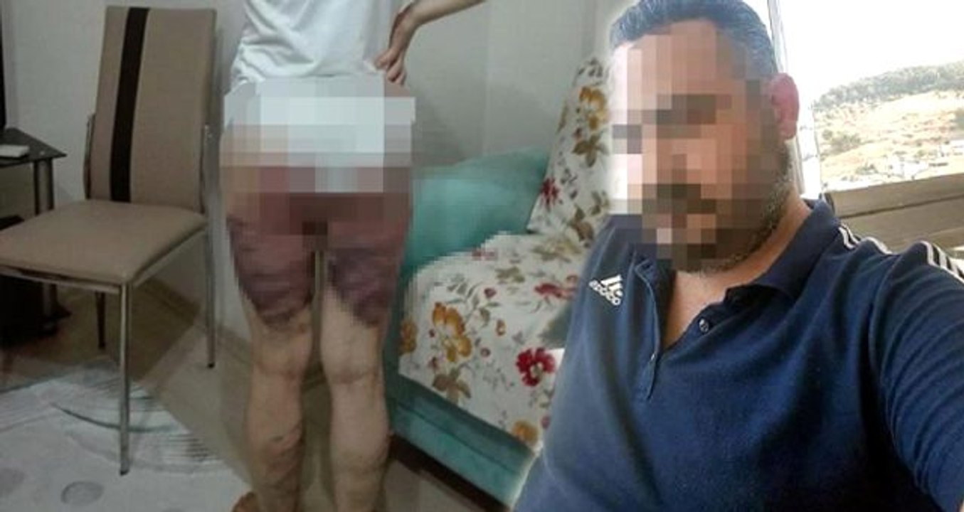 İçler acısı görüntü! Karısını bacakları çürüyene kadar döven koca 8 yıl hapis aldı