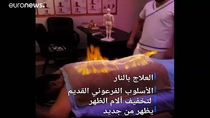 مصر: إن كنت تعاني من آلام الظهر.. فيمكنك علاجه بتقنية "التدليك الناري"