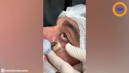 Cernes, vergetures, cicatrices…  ce tatoueur est capable  de les faire disparaître !